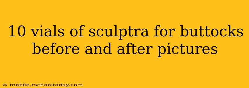10 vials of sculptra for buttocks before and after pictures