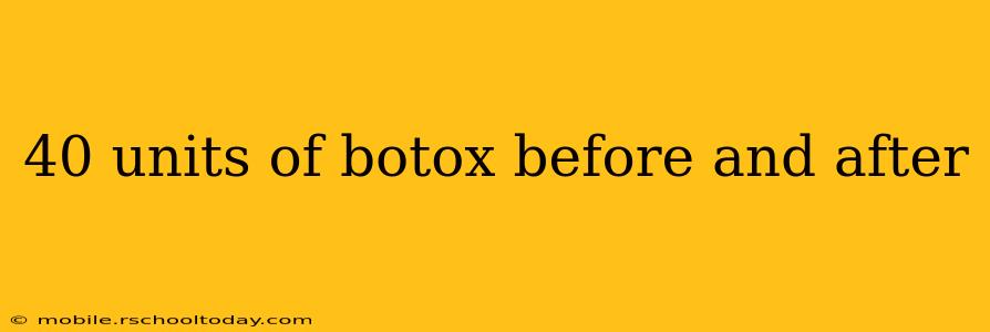 40 units of botox before and after