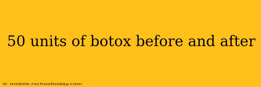 50 units of botox before and after