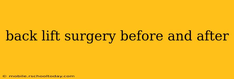 back lift surgery before and after