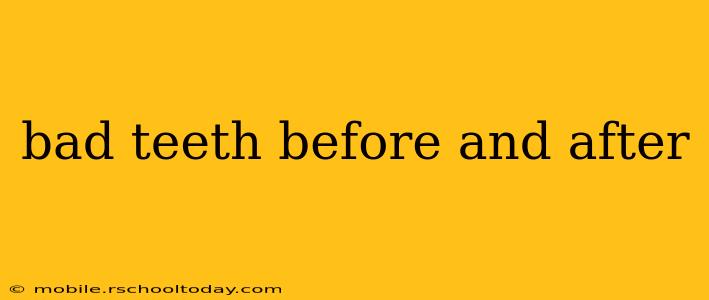 bad teeth before and after