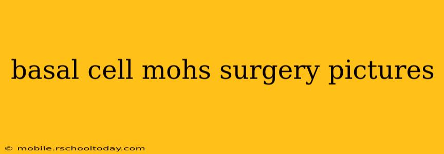 basal cell mohs surgery pictures