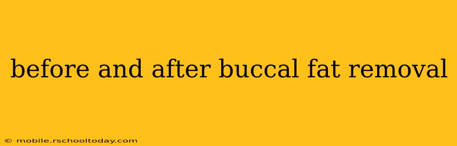 before and after buccal fat removal