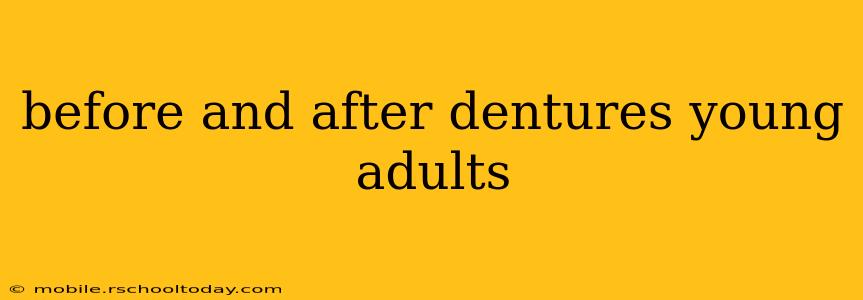 before and after dentures young adults