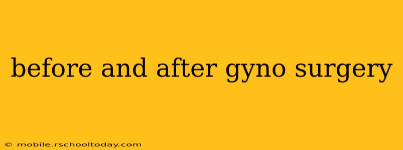 before and after gyno surgery