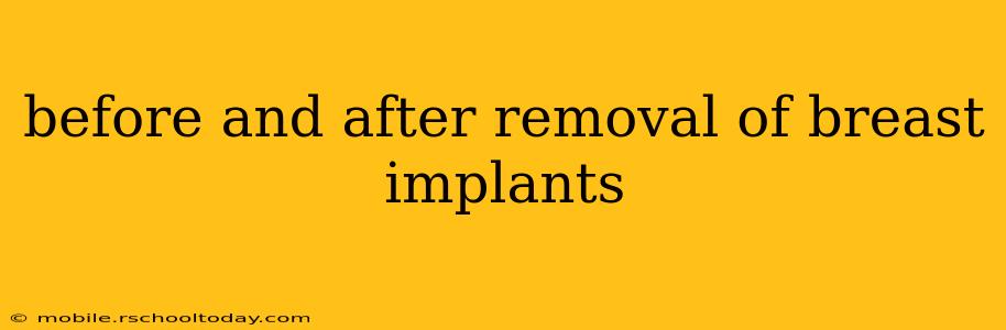 before and after removal of breast implants