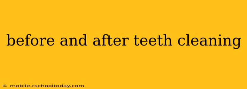before and after teeth cleaning