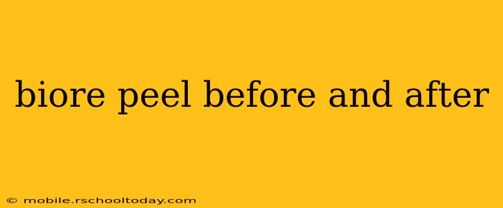 biore peel before and after