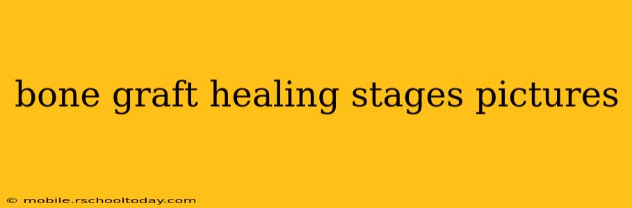 bone graft healing stages pictures