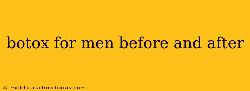 botox for men before and after