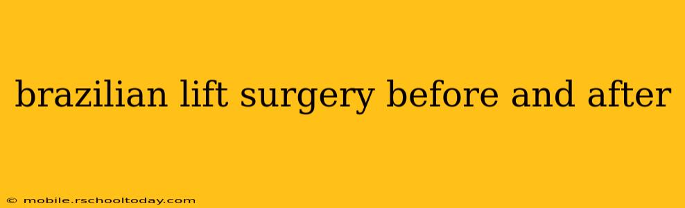 brazilian lift surgery before and after
