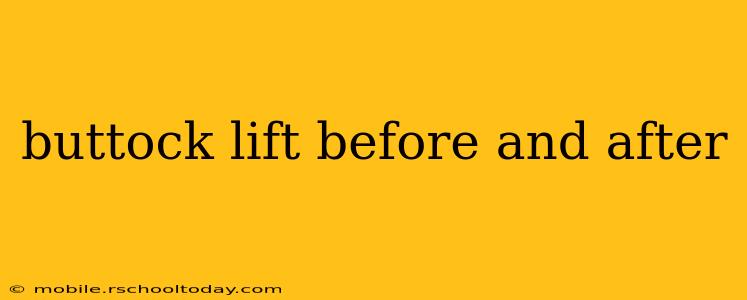buttock lift before and after