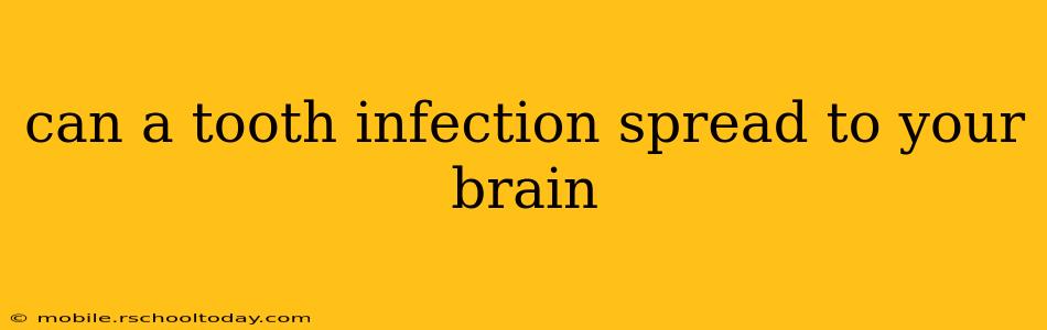 can a tooth infection spread to your brain