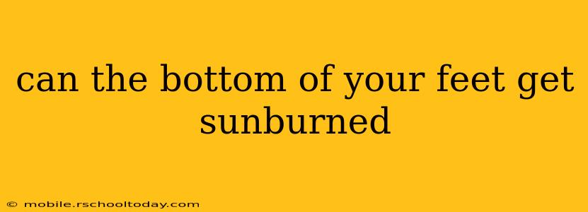 can the bottom of your feet get sunburned