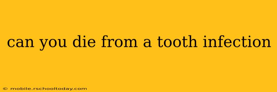 can you die from a tooth infection