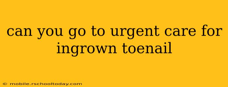 can you go to urgent care for ingrown toenail