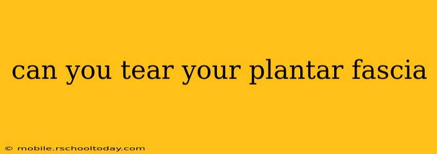 can you tear your plantar fascia