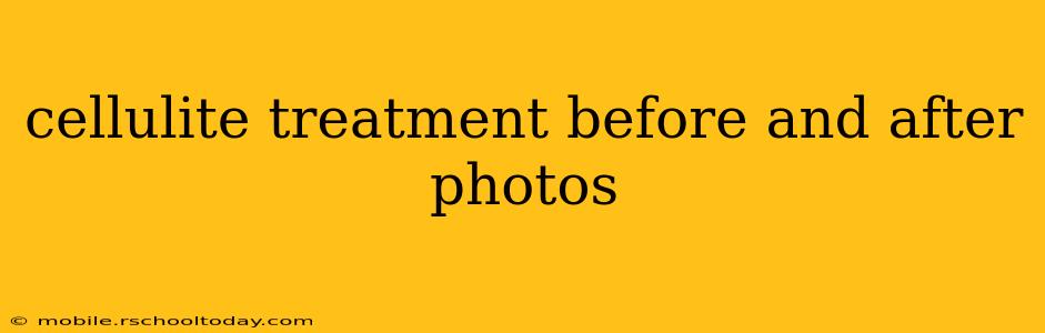 cellulite treatment before and after photos