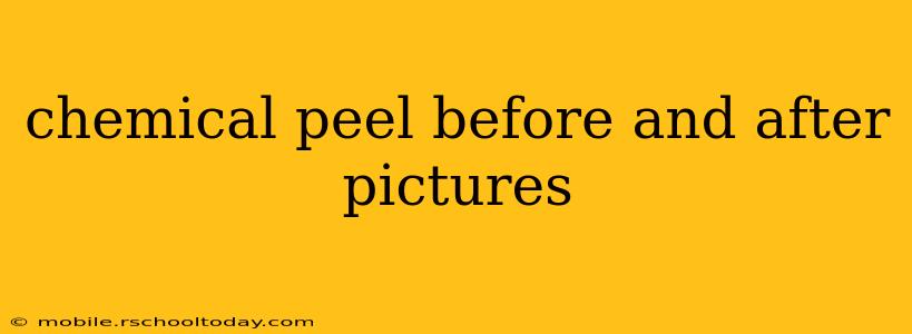 chemical peel before and after pictures