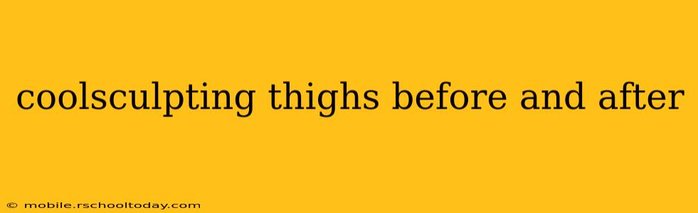 coolsculpting thighs before and after
