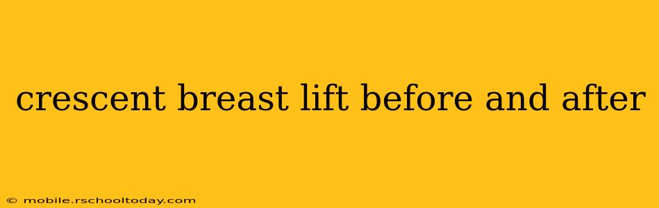 crescent breast lift before and after