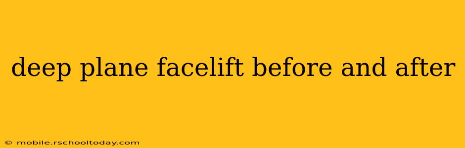 deep plane facelift before and after