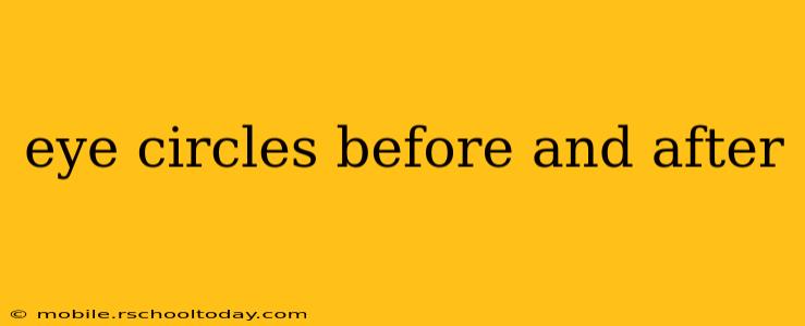 eye circles before and after