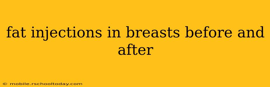 fat injections in breasts before and after