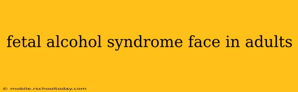 fetal alcohol syndrome face in adults