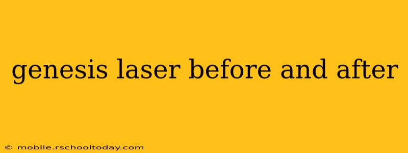 genesis laser before and after