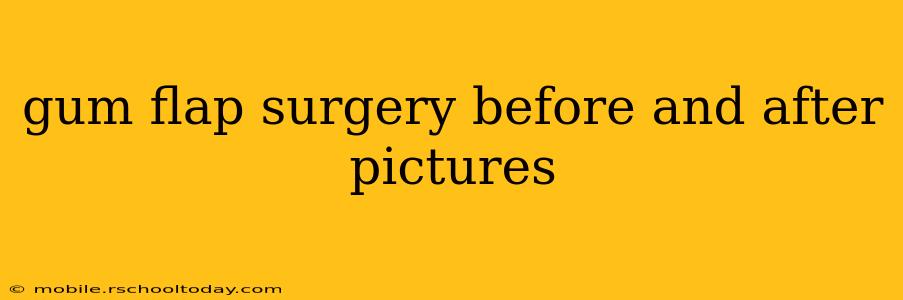 gum flap surgery before and after pictures