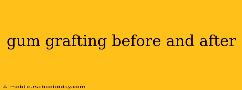 gum grafting before and after