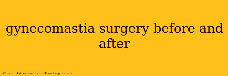 gynecomastia surgery before and after