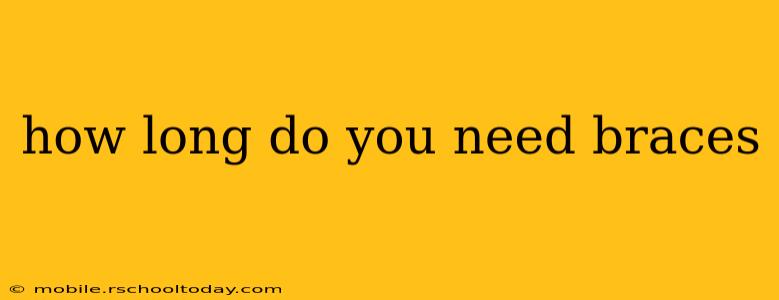 how long do you need braces