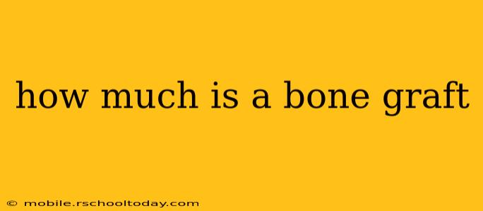 how much is a bone graft