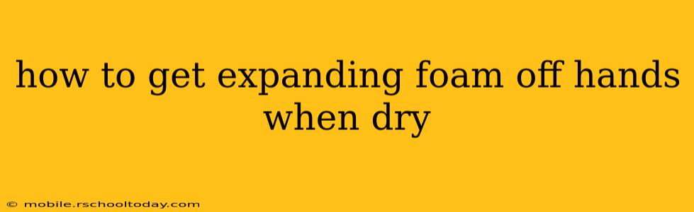 how to get expanding foam off hands when dry