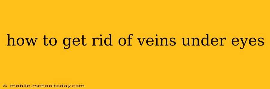 how to get rid of veins under eyes