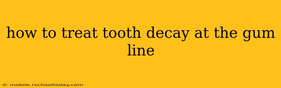 how to treat tooth decay at the gum line