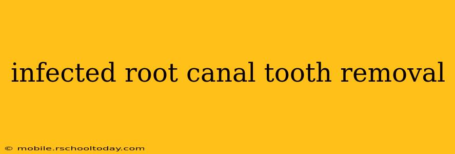 infected root canal tooth removal