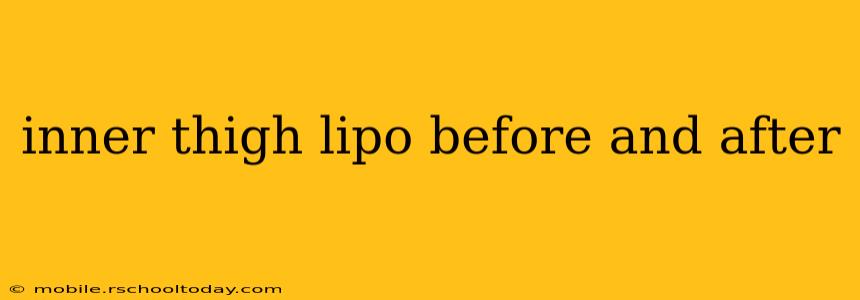inner thigh lipo before and after