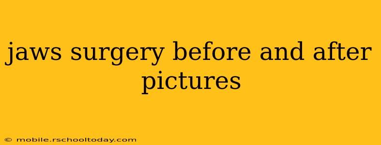 jaws surgery before and after pictures