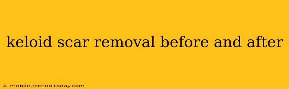 keloid scar removal before and after