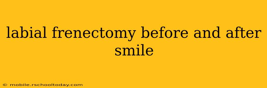 labial frenectomy before and after smile