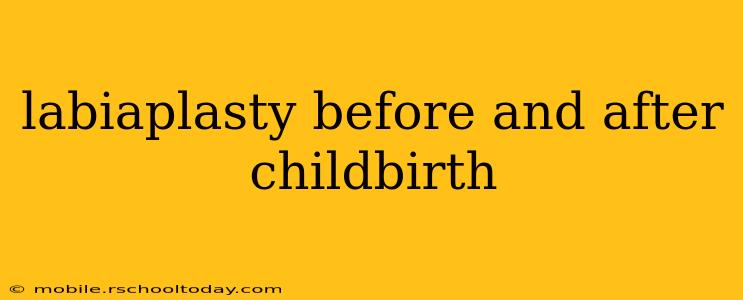 labiaplasty before and after childbirth