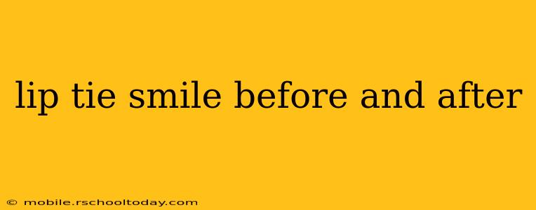 lip tie smile before and after