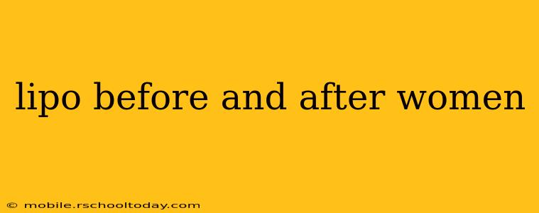 lipo before and after women