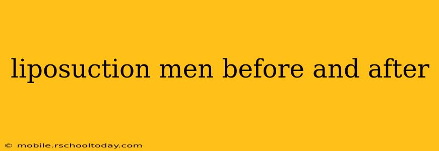 liposuction men before and after
