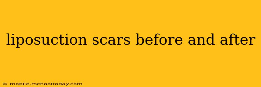 liposuction scars before and after