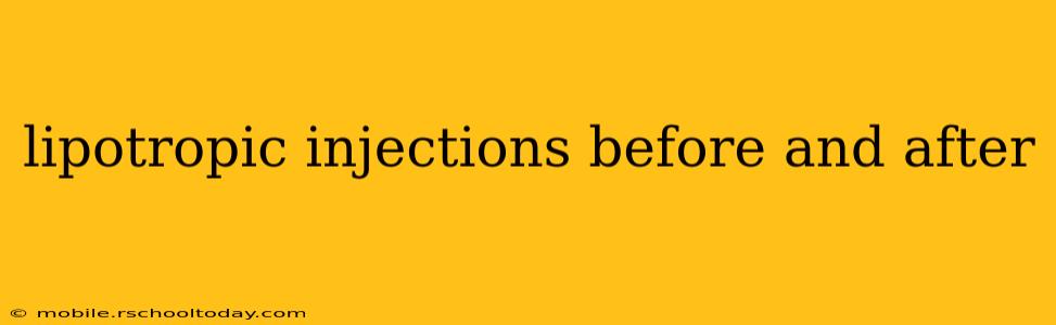 lipotropic injections before and after