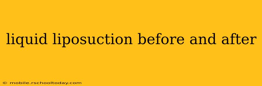 liquid liposuction before and after